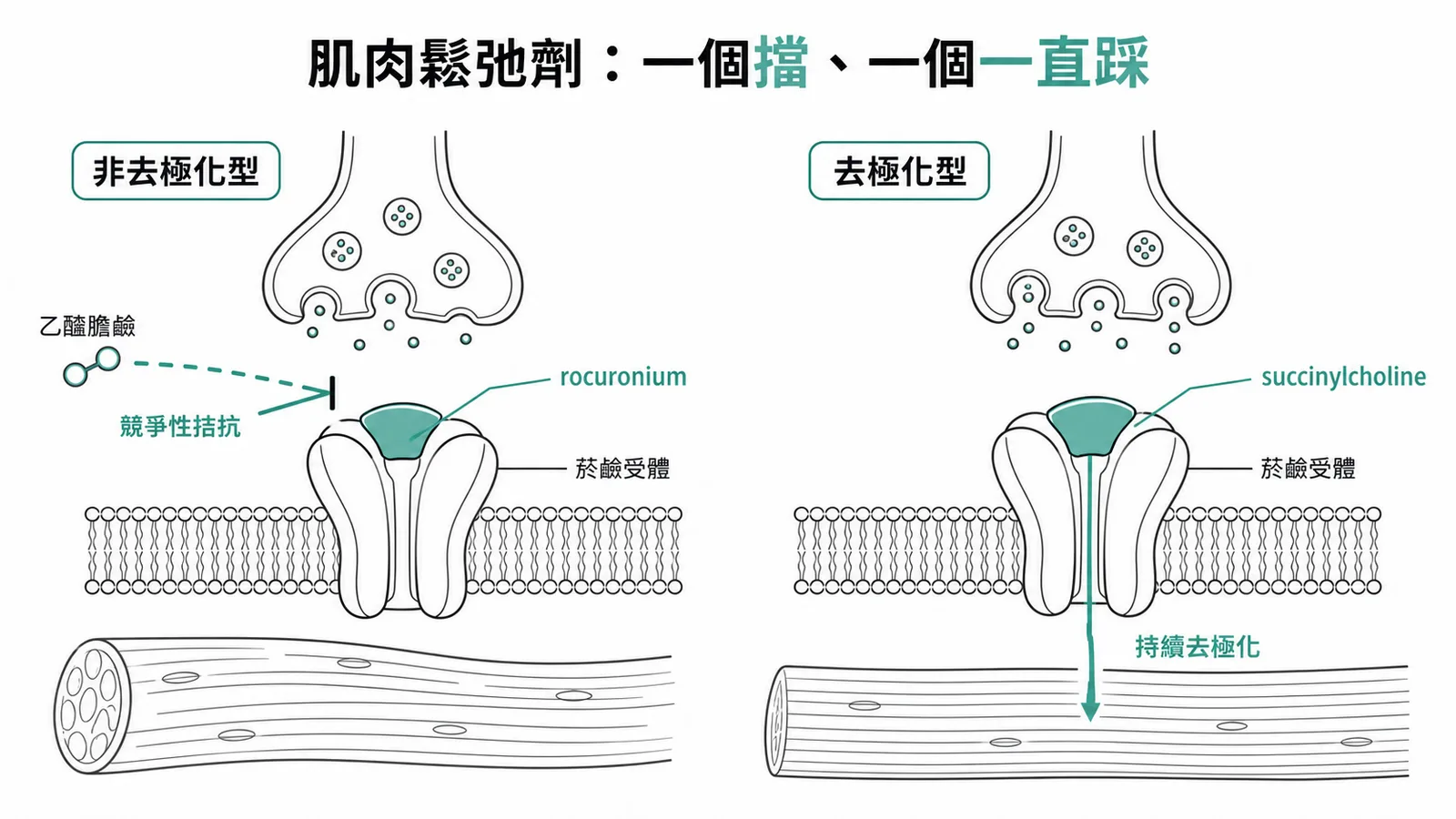 神經肌肉阻斷劑兩型對照:非去極化型(rocuronium 等)是菸鹼受體競爭性拮抗劑、卡住受體不讓乙醯膽鹼作用;去極化型(succinylcholine)是菸鹼受體促效劑、造成肌肉持續去極化