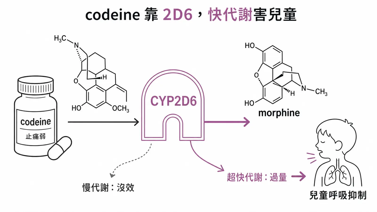 codeine 要經 CYP2D6 變成 morphine 才止痛;超快代謝者生成過多 morphine,兒童會致命呼吸抑制