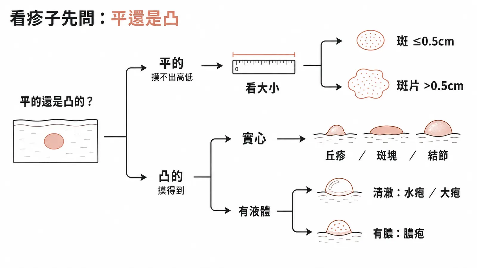 皮膚病灶型態判讀流程:先觸診分辨平坦或隆起,再看大小是否超過 0.5 公分、有無充填液體,逐步收斂到斑、斑片、丘疹、斑塊、結節、水疱、大疱或膿疱