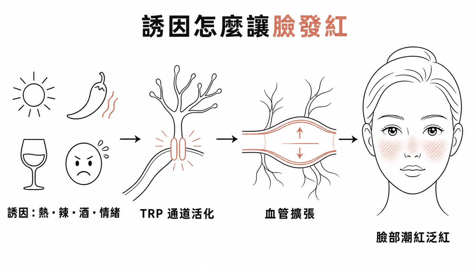酒糟神經血管機轉:熱、辣、酒精、情緒等誘因活化感覺神經上的 TRP 通道,造成血管擴張與臉部潮紅泛紅