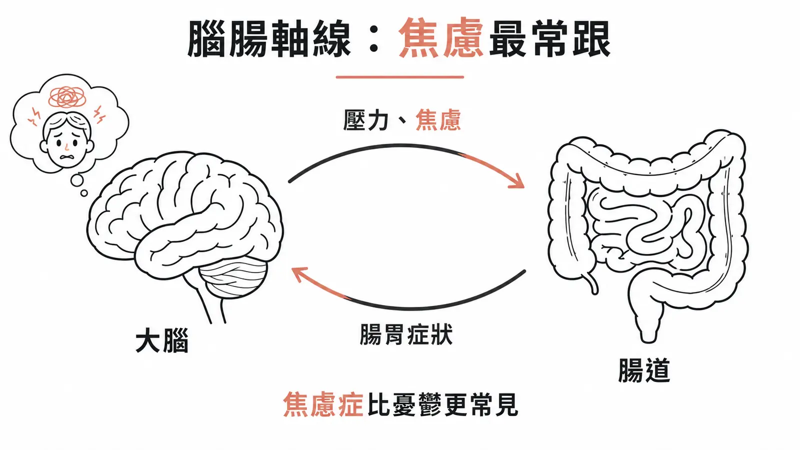 功能性腸胃障礙走腦腸軸線,最常伴隨的精神疾患是焦慮症,比憂鬱更常見