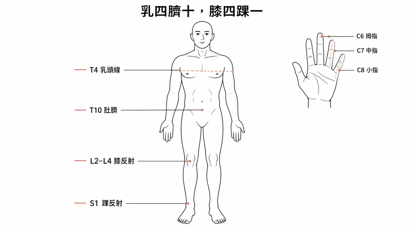 常考脊髓定位地標：T4 乳頭、T10 肚臍、L2 至 L4 膝反射、S1 踝反射