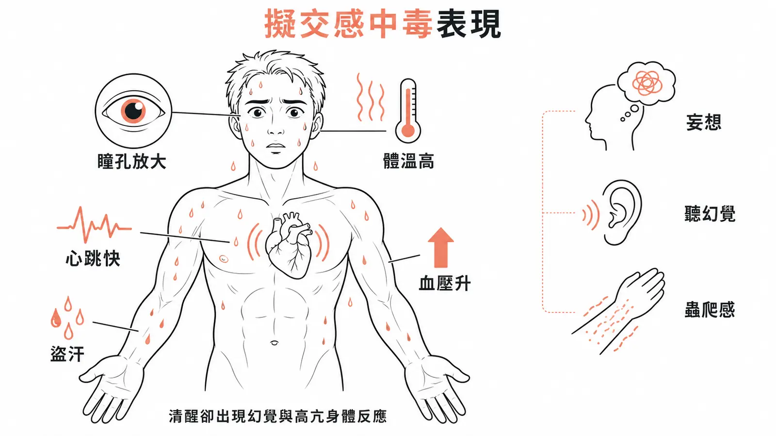 興奮劑中毒的擬交感表現：瞳孔放大、體溫高、心跳快、血壓升、盜汗、妄想、聽幻覺、蟲爬感