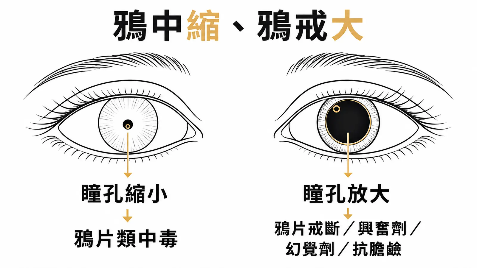 瞳孔速查:鴉片中毒縮小、鴉片戒斷與興奮劑及幻覺劑放大