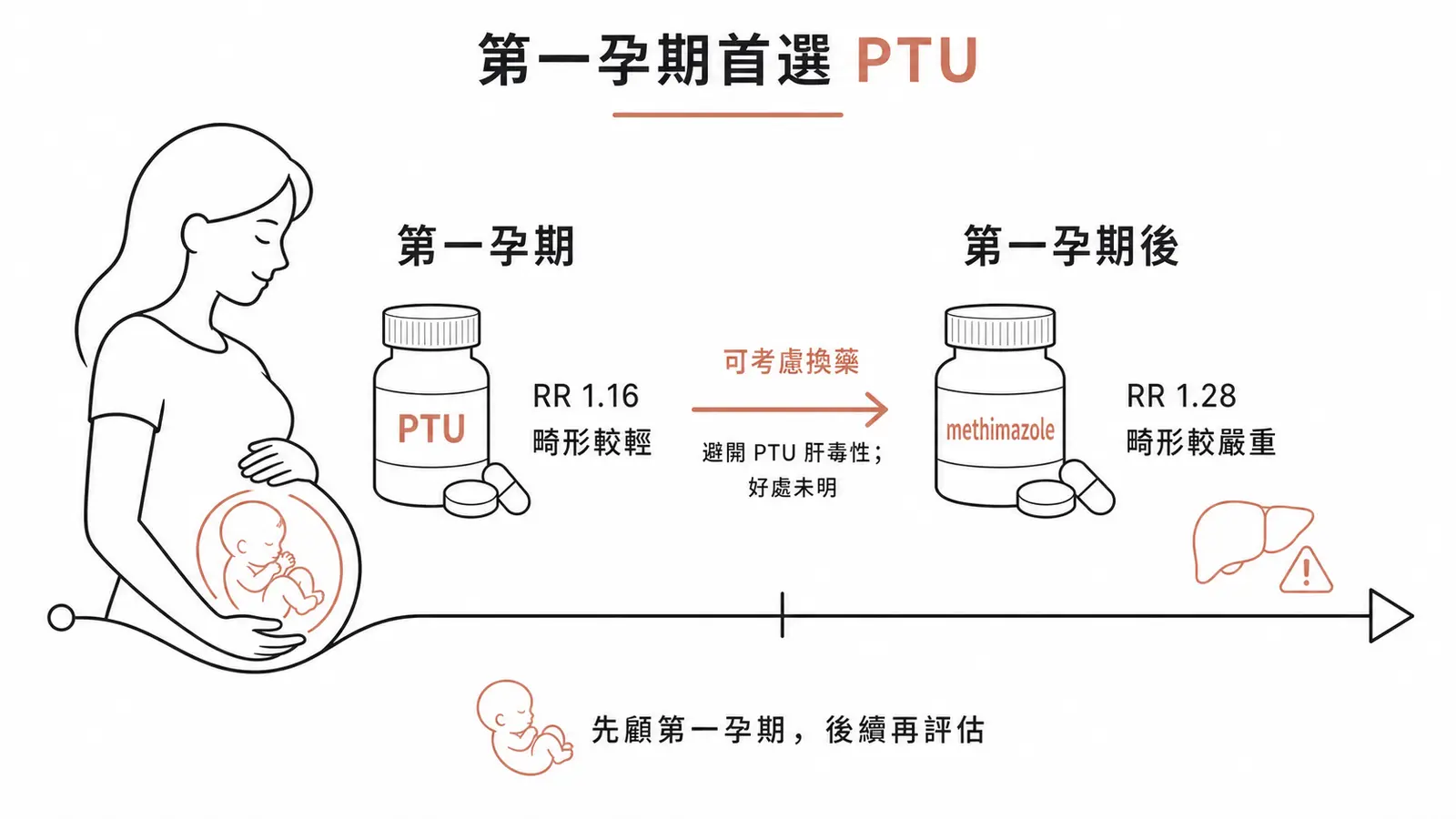 懷孕期抗甲狀腺藥選擇:第一孕期首選 PTU 線稿圖