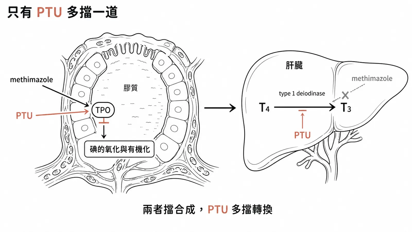 抗甲狀腺藥物 methimazole 與 PTU 作用機轉差異線稿圖