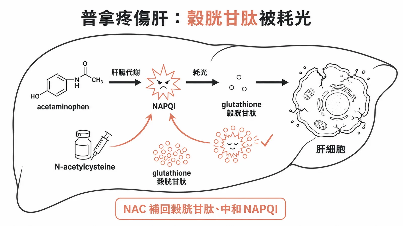 acetaminophen 中毒機轉:過量時肝臟產生毒性代謝物 NAPQI 把穀胱甘肽耗光、傷肝,N-acetylcysteine 補回穀胱甘肽讓 NAPQI 被中和