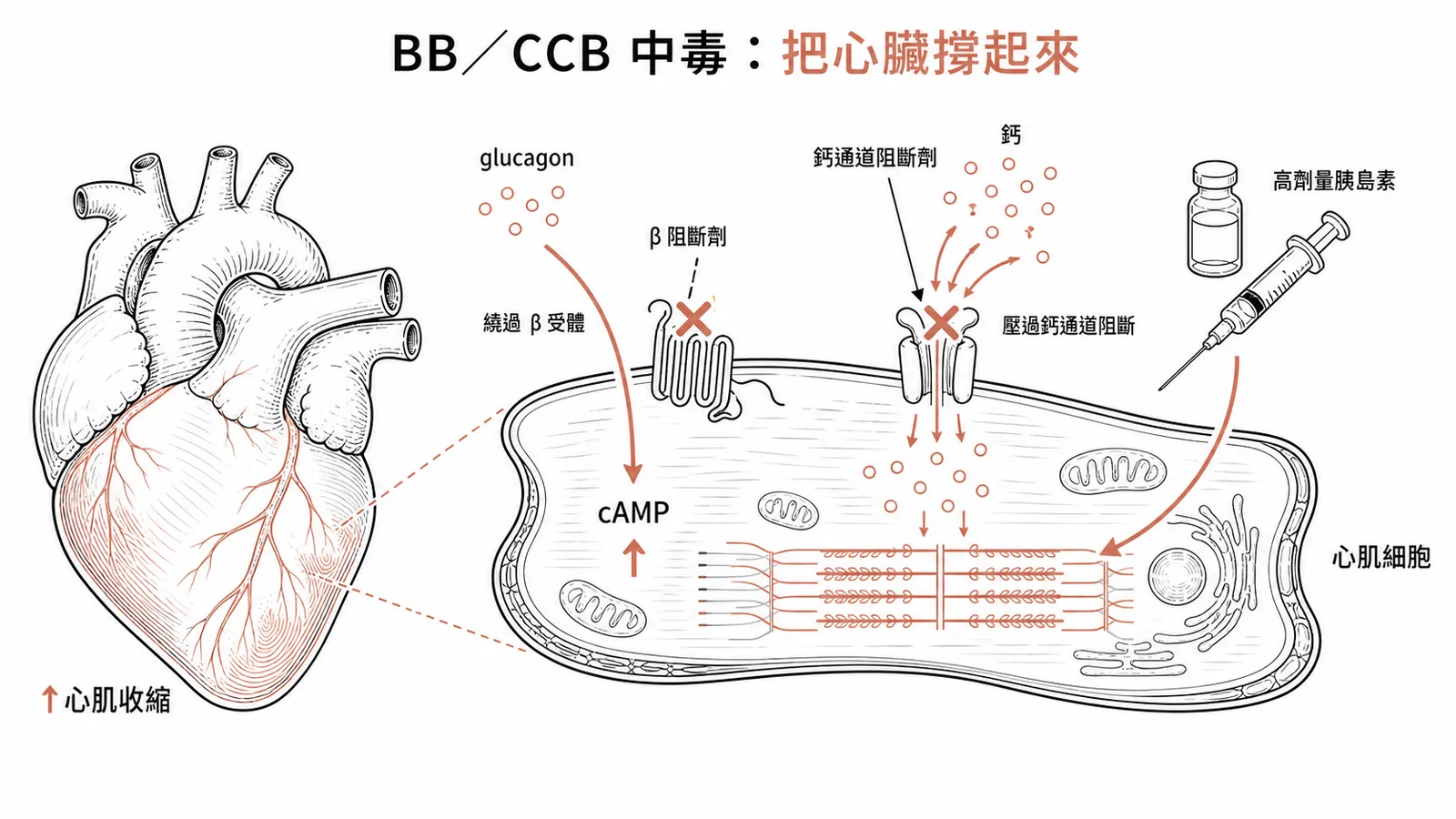 β 阻斷劑與鈣通道阻斷劑中毒的心臟支持:glucagon 繞過 β 受體直接把 cAMP 拉高、鈣壓過被阻斷的鈣通道,並早期給高劑量胰島素增強心肌收縮